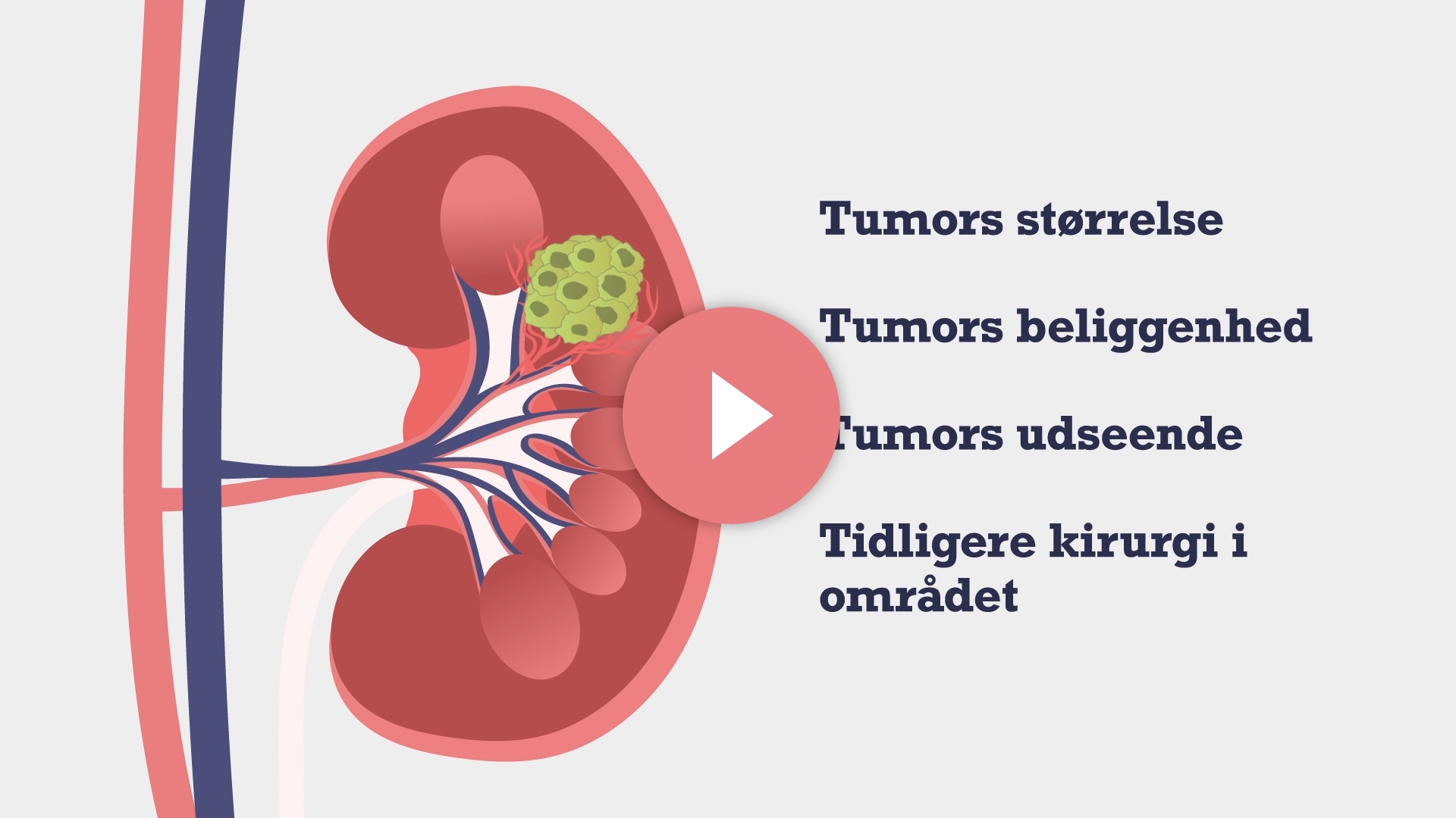 Daman_New_KidneyCancer_Video_11_03_Thumbnail